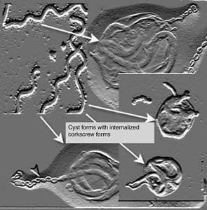 Eine Darstellung der Umwandlung von flaschenzieher-geformten Borrelia burgdorderi (links oben) in zystische Formen.