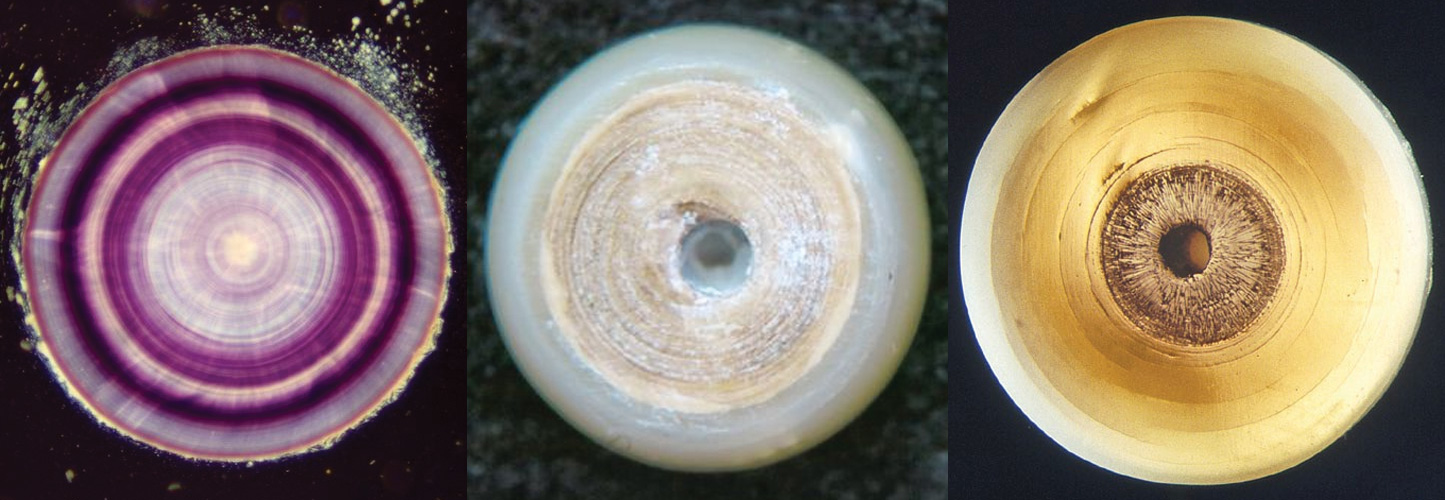 Querschnitt durch natürlich gewachsene Perlen.