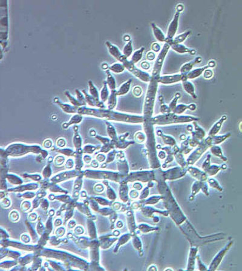Konidiophoren des Schlauchpilzes Trichoderma harzianum, mit neu gebildeten Sporen (Konidien) an den Spitzen der vasenförmigen Phialiden (helle Punkte).