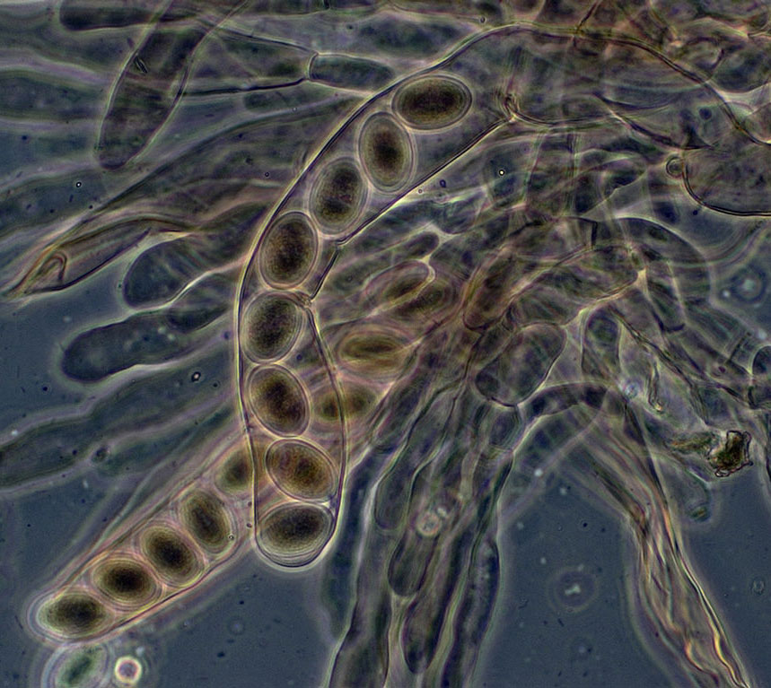 Bei der geschlechtlichen Fortpflanzung bilden Schlauchpilze (Ascomycota) Schläuche (Asci) mit Sporen. Zu diesen Pilzen gehören z.B. die Hefe, die Schimmelpilze, die Trüffel sowie – wie hier dargestellt – die Spitzmorchel.