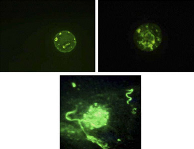 Die zystischen Formen von Borrelia burgdorferi mit eingelagerten K&ouml;rnchen.